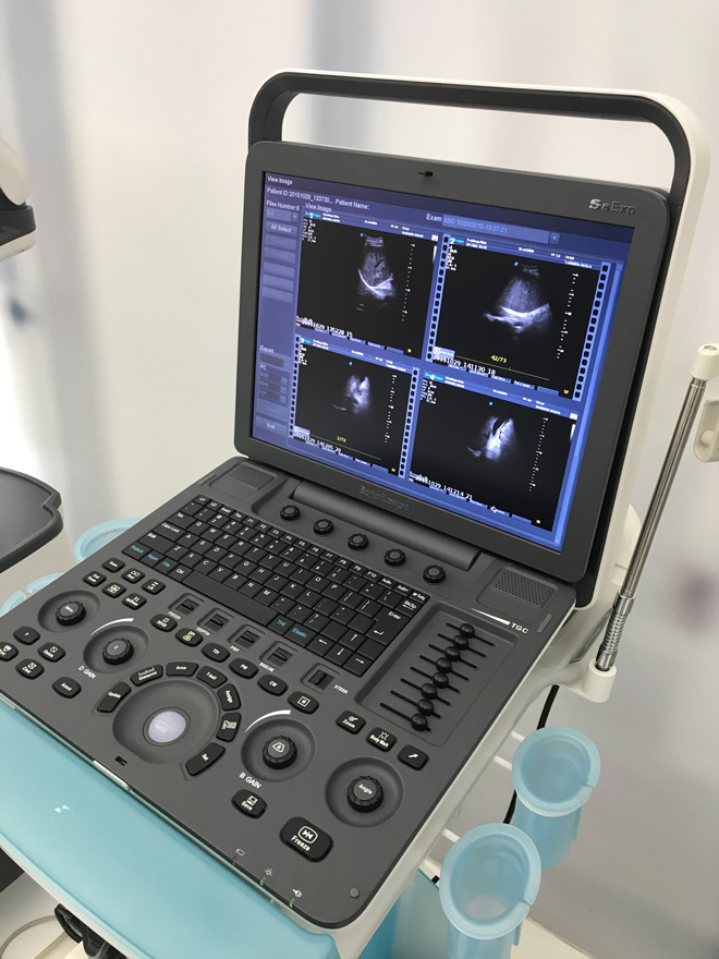 handheld ultrasound machine for sale