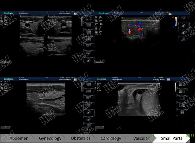 ultrasonido obstetrico pdf