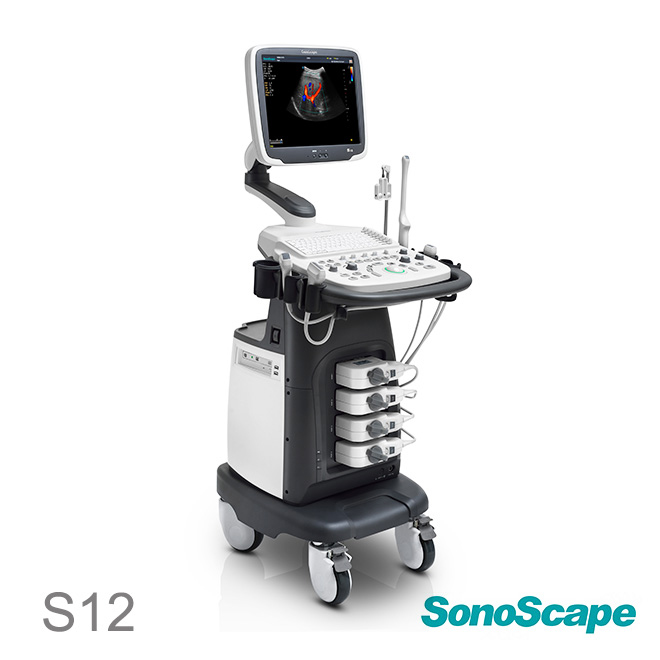 SonoScape S12