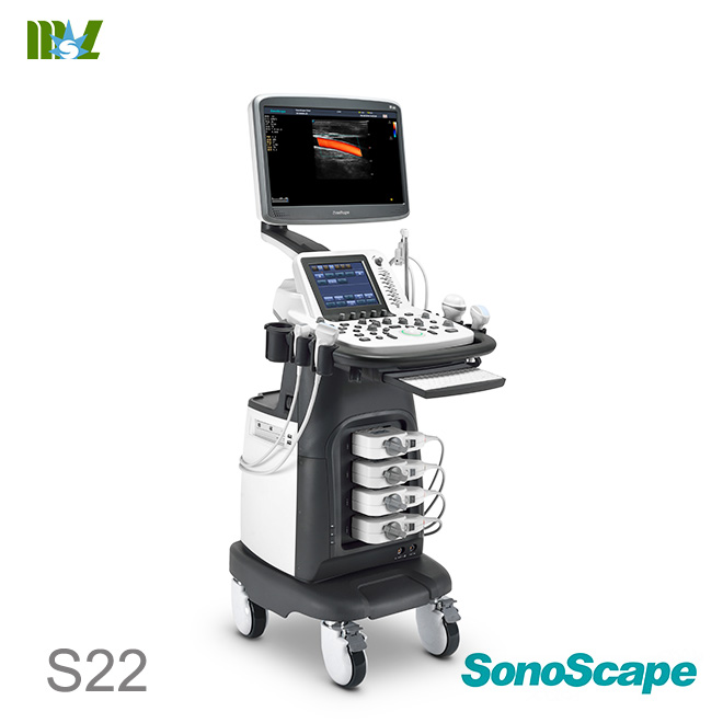 SonoScape S22