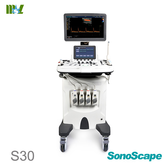 SonoScape S30