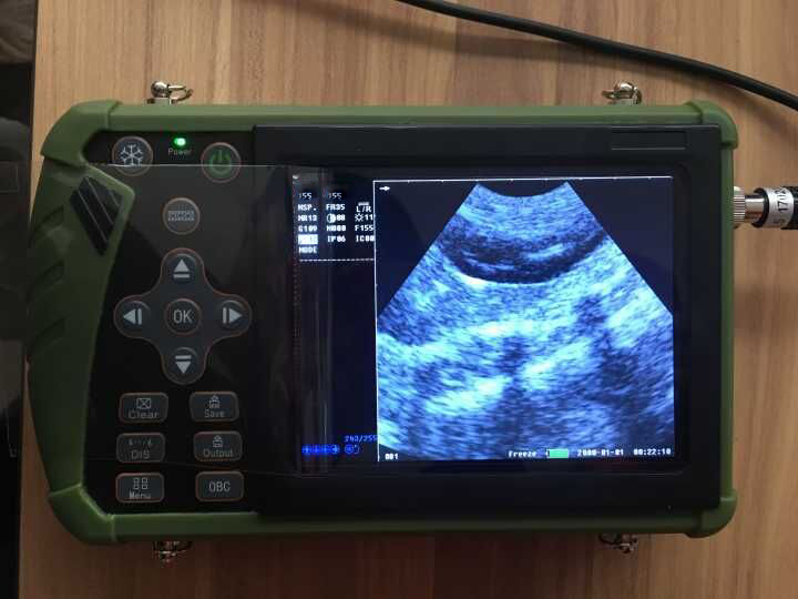 ultrasound machine price list