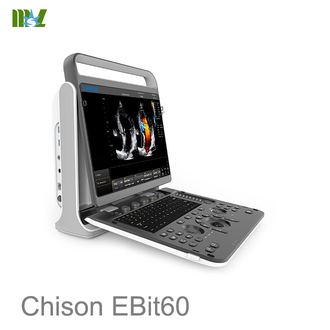 Chison ultrasound Chison EBit 60