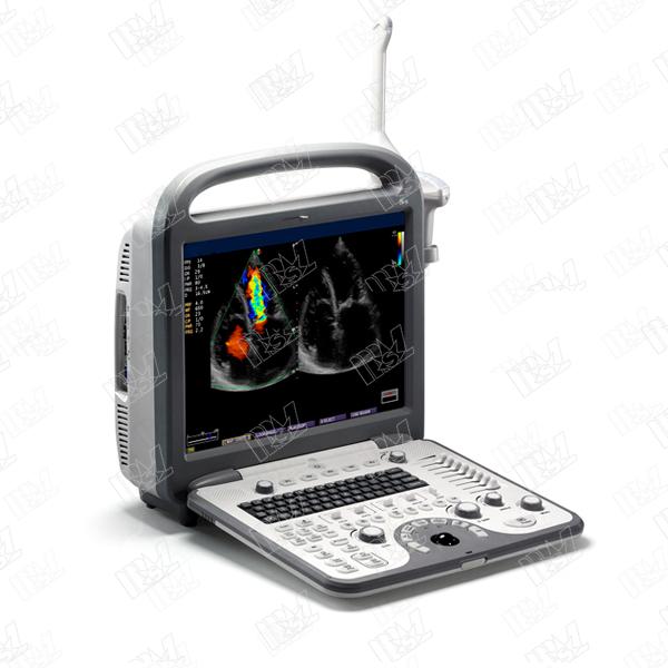 Sonoscape S8 Cardiac Stress Echo color doppler ultrasound