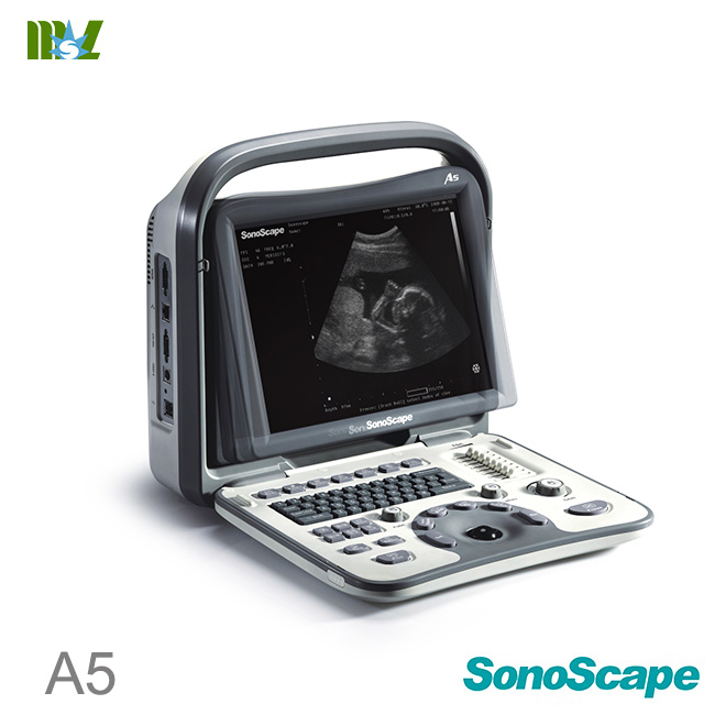 ultrasonido portatil sonoscape a5 price list : ultrasonido abdominal