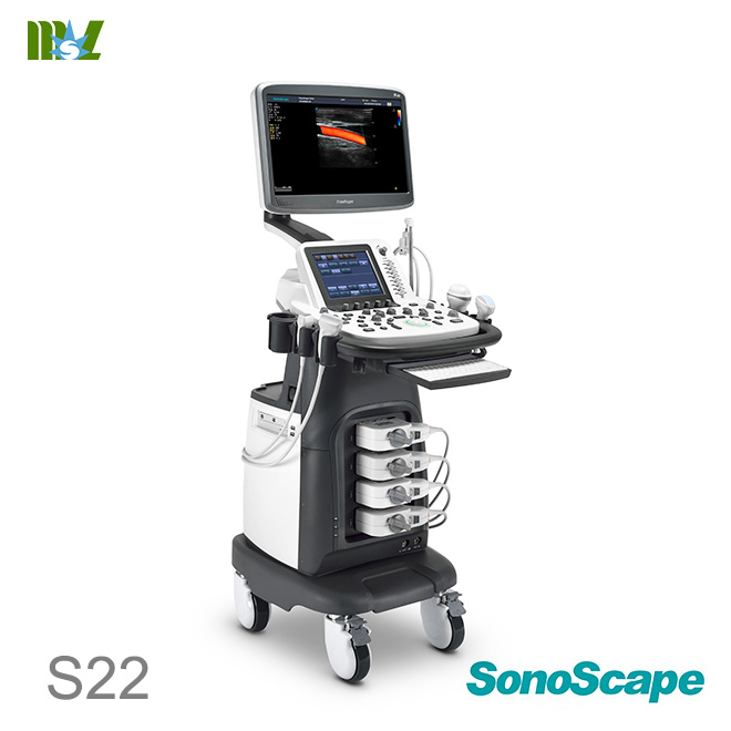Eco doppler carotidian SonoScape S22 price : eco doppler