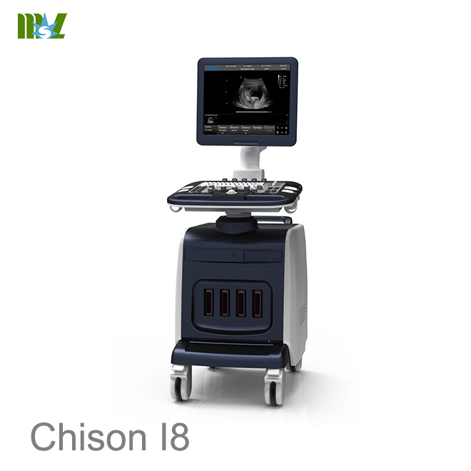ultrasonido abdominal chison i8 : ultrasonido 4d doppler obstetrico