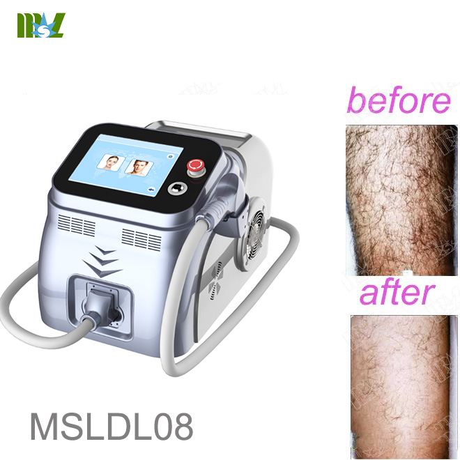 Best permanent painless facial ipl hair removal MSLDL08 cost