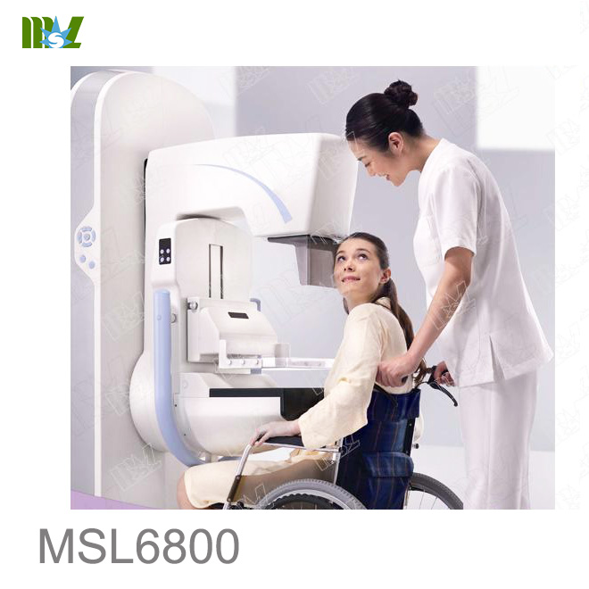 digital mammography system