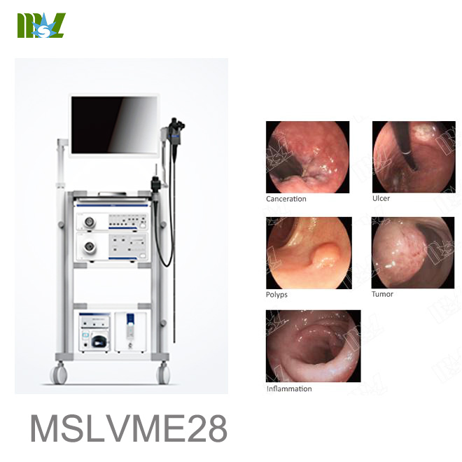 endoscopy test MSLVME28