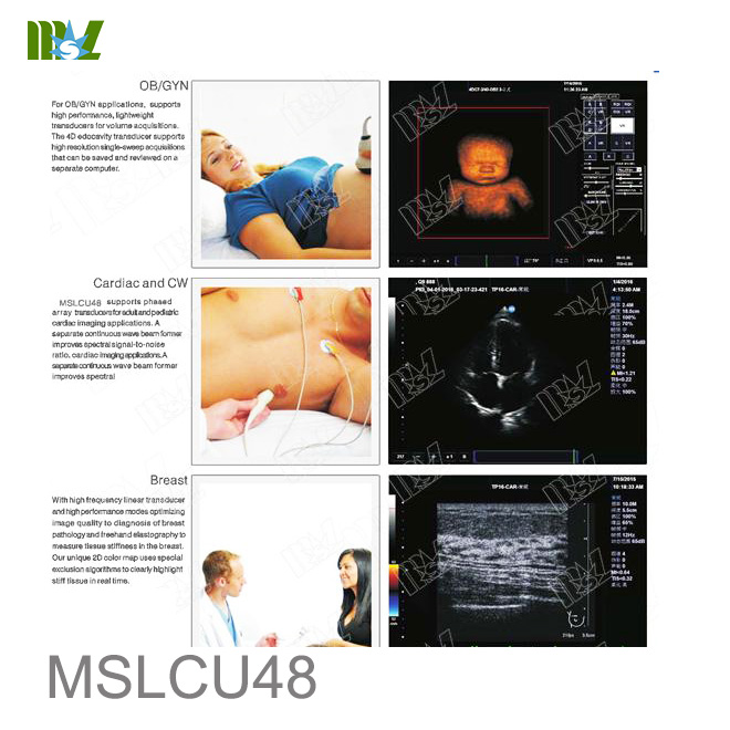 musculoskeletal sonography
