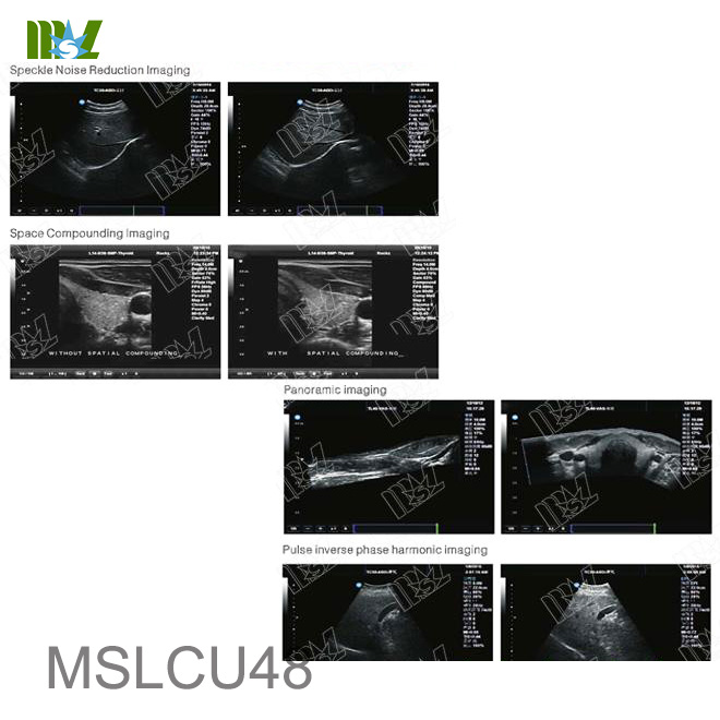 Musculoskeletal ultrasound | Radiology