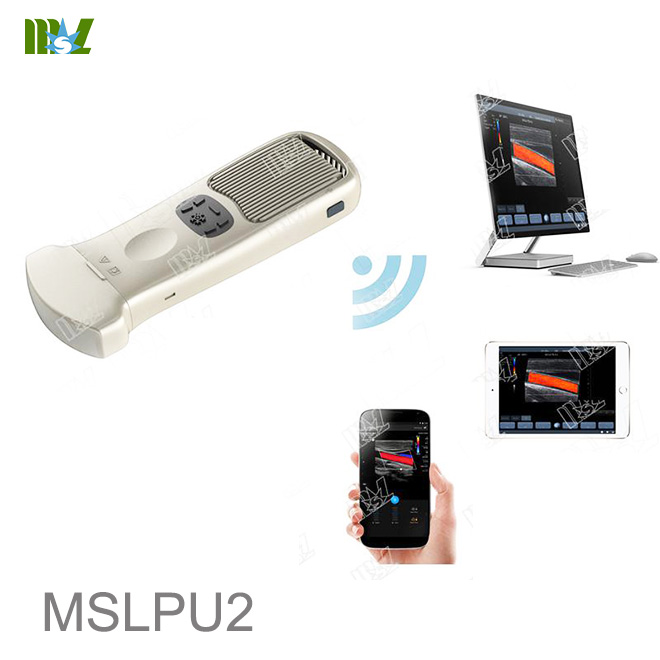 Wireless Ultrasound Linear Probe Black and White - ATL - L10B