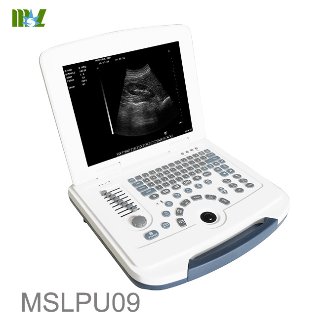 early ultrasound