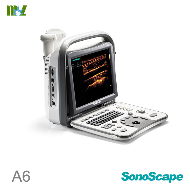 Sonoscape ultrasound sonoscape a6 price: ultrasound machine