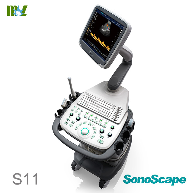 Eco doppler vascular SonoScape S11 price : doppler vascular