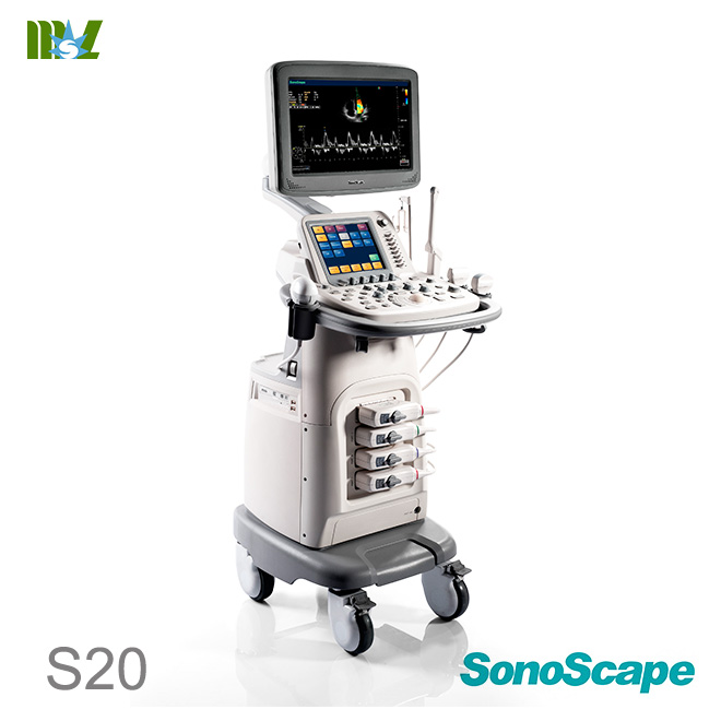 ecografie endovaginala SonoScape S30 price | ecografie doppler