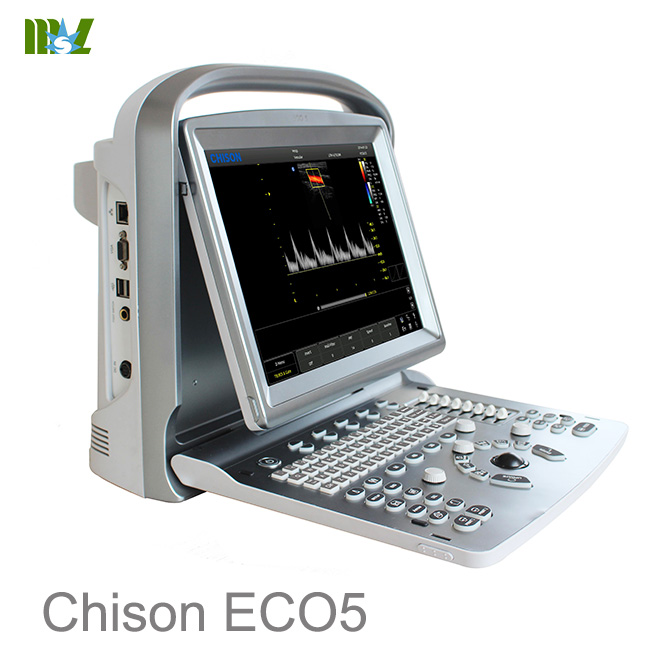 Ultrasonido (ecografo) abdominal con Doppler : chison eco 5 approved FDA