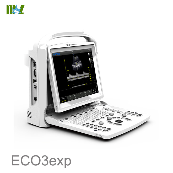 Ultrasonido portatil doppler Chison EC03exp price