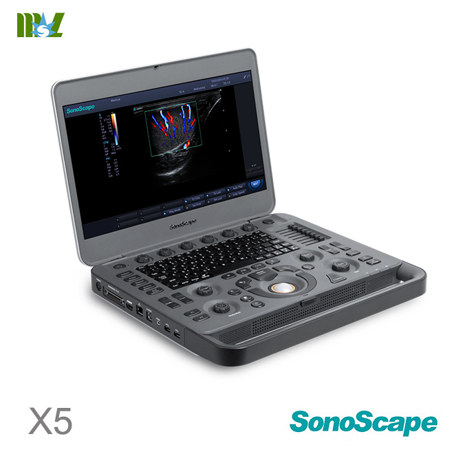 ultrasonido portatil doppler SonoScape X5 price : ultrasonido terapeutico