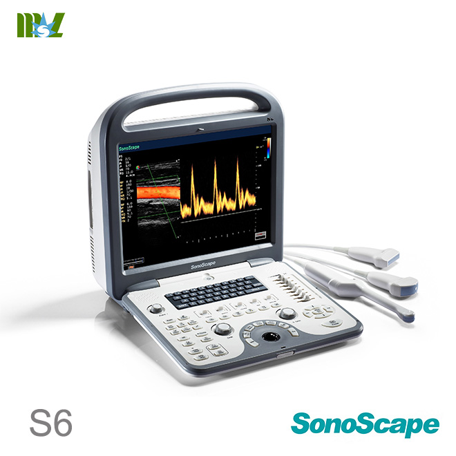 ultrasonido 4d sonoscape s6 price | ecografie 4d