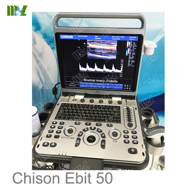 ultrasonido 4d doppler vascular Chison Ebit 50 price