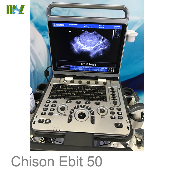 Chison Ebit 50