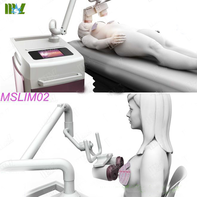 breast mastopathy treatment