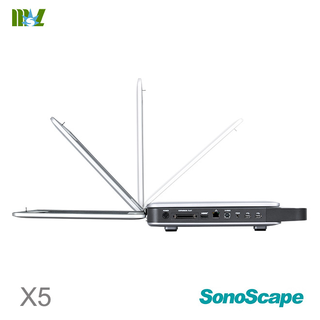 sonoscape X5 3d scanner