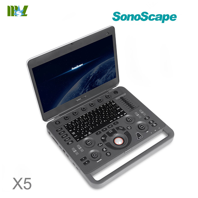 sonoscape X5 4d ultrasound