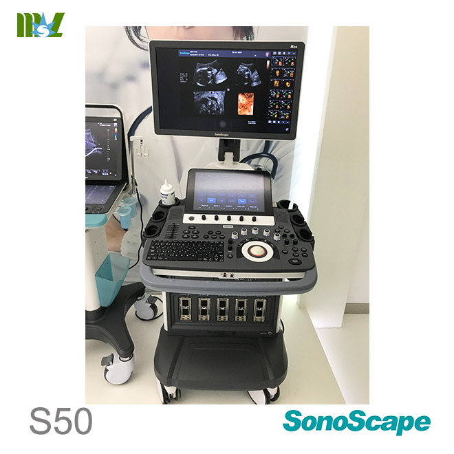 sonoscape S50 baby ultrasound scan