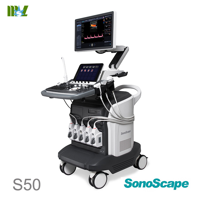 sonoscape S50 ultrasound scan