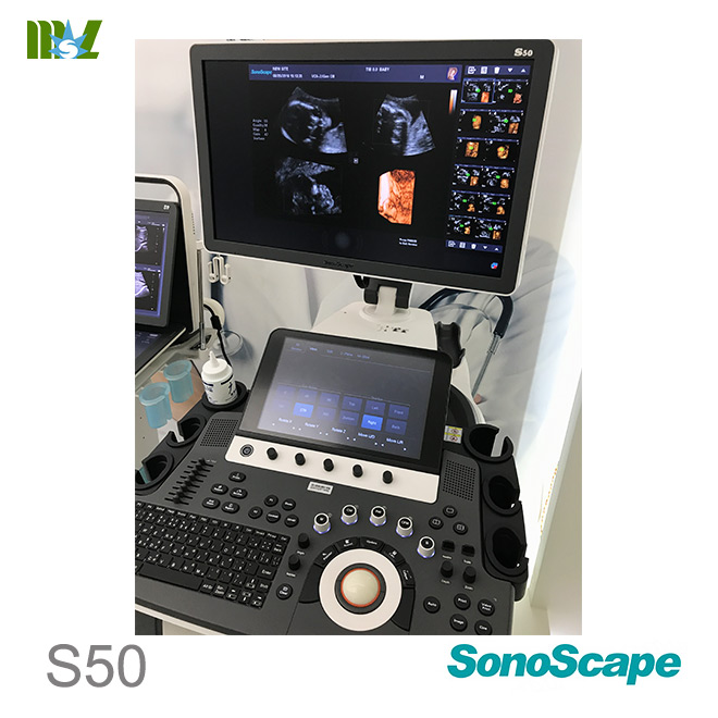 sonoscape S50 ultrasound scan price