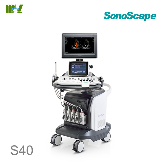 Sonoscape S40 4d ultrasound