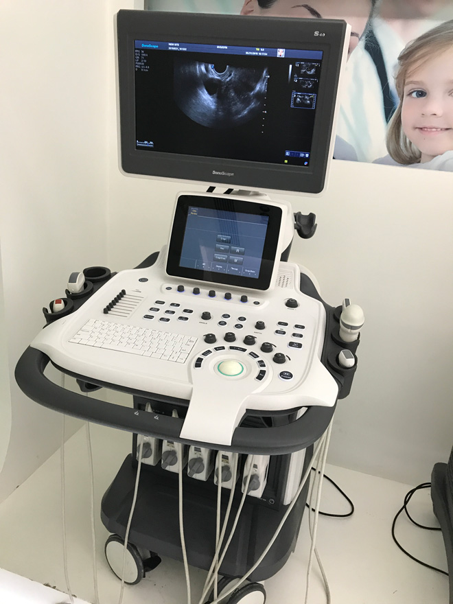 Sonoscape S40 ultrasound scan