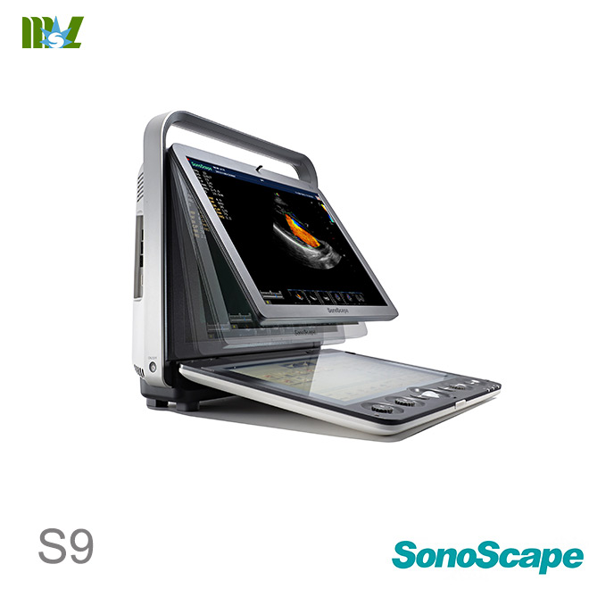 sonoscape S9 4d baby scan