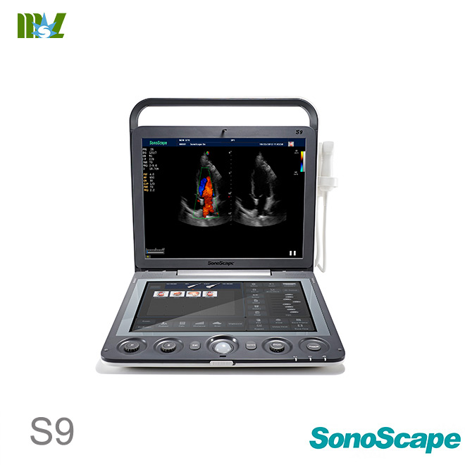 sonoscape S9 portable ultrasound machine