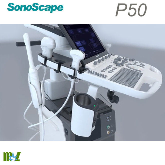 pregnancy scan sonoscape p50