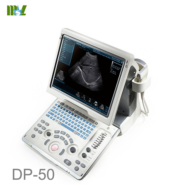 indray ultrasound