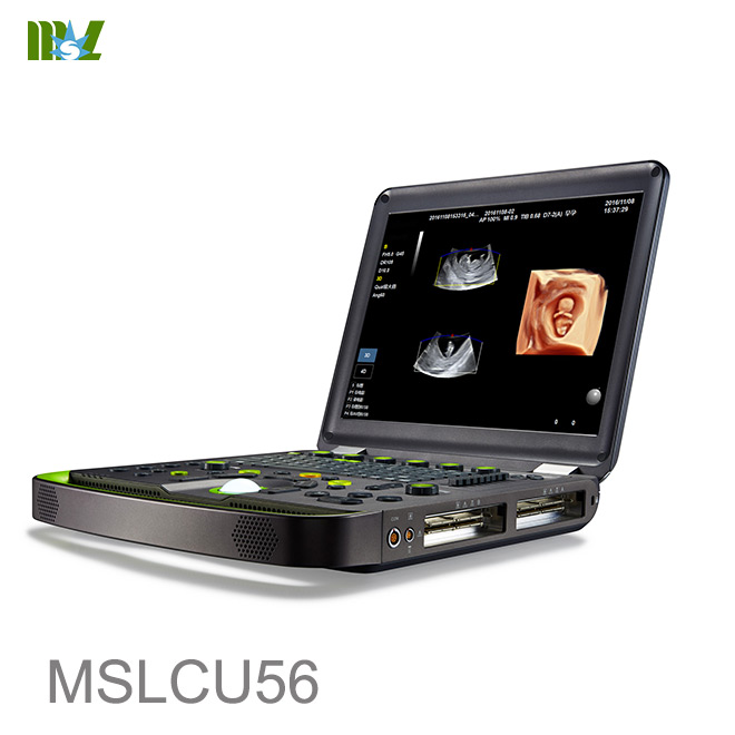 diagnostic ultrasound