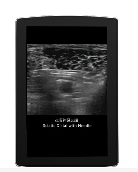 cardiac ultrasound