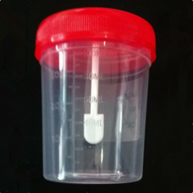 stool sample container