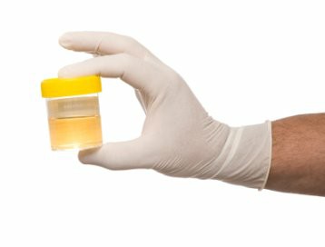 urine collection