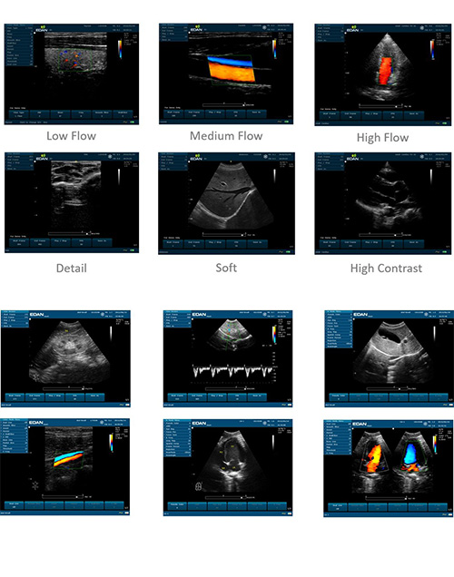 Edan U60 Diagnostic Ultrasound System
