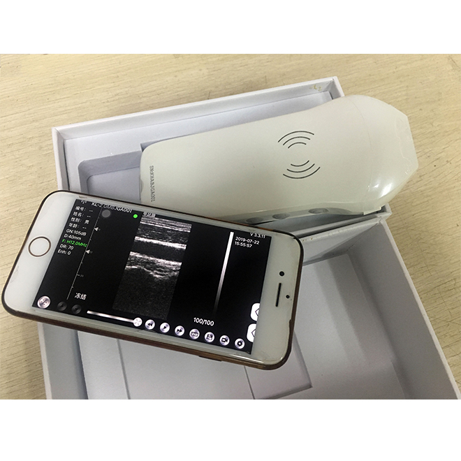 small-ultrasound-scanner-MSLPU65