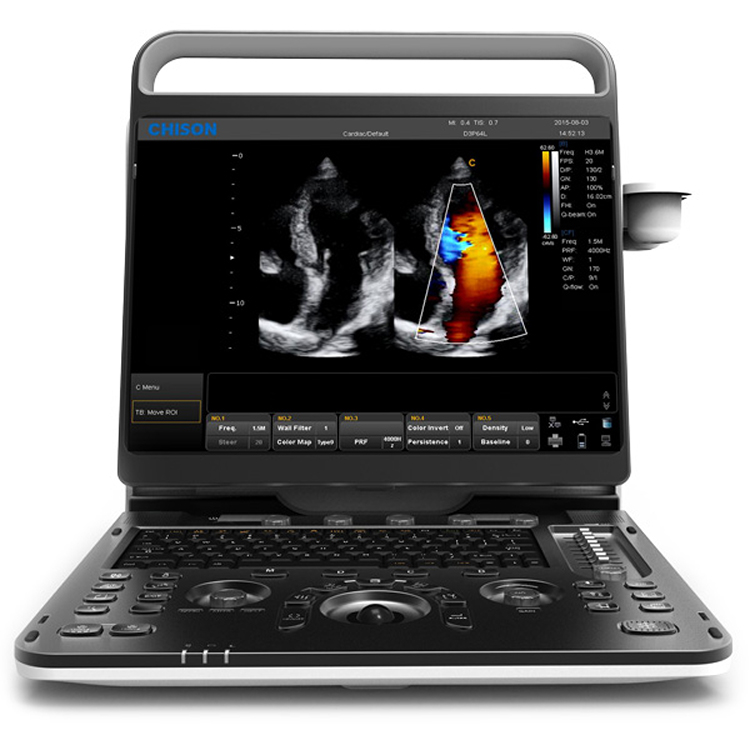 Professional Ultrasound equipment MSLCU39