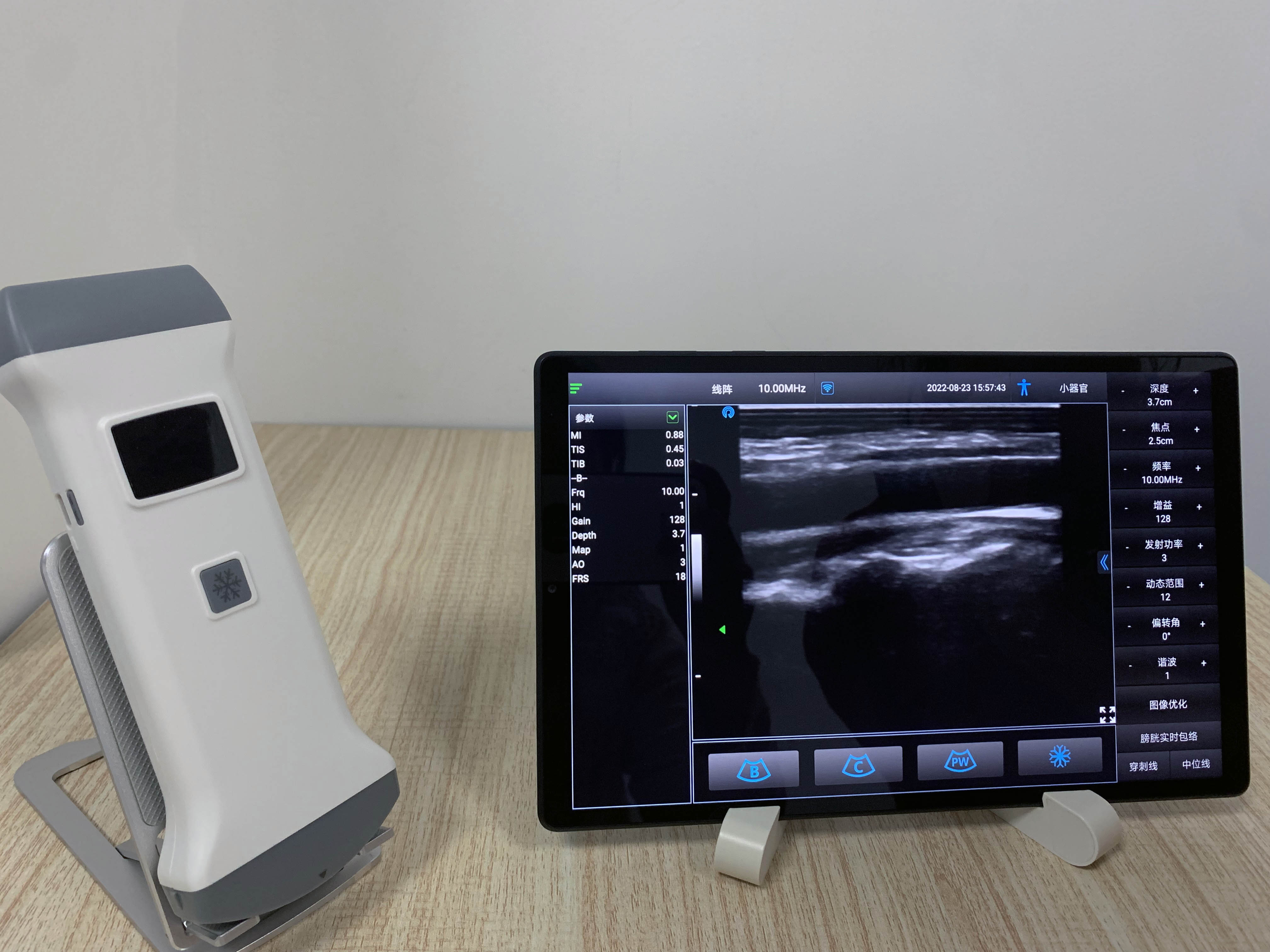 wireless ultrasound : wireless ultrasound probe ipad MSLPU40